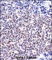 NFATC1 Antibody (C-term)